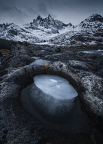 The eye